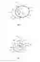 Fig. 04 - Clinical testing blinding tubes and method of assembly