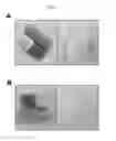 Fig. 02 - Pharmaceutical Composition Comprising Temozolomide With Improved Stability and Process for Manufacturing the Same