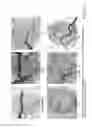 Fig. 26 - Nanoparticle and polymer formulations for thyroid hormone analogs, antagonists, and formulations and uses thereof