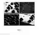 Fig. 04 - Topical drug patch including microspheres