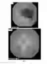 Fig. 02 - Nutritional formulas comprising medium chain fatty acids or esters thereof and methods related thereto