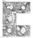 Fig. 06 - Composition containing monoacetyldiacylglycerol compound as active ingredient for preventing or treating asthma