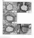Fig. 07 - Composition containing monoacetyldiacylglycerol compound as active ingredient for preventing or treating asthma