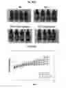Fig. 10 - Calebin A for hepatic steatosis