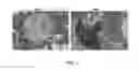 Fig. 08 - COMPOUNDS AND FORMULATIONS FOR THE TREATMENT OF WOUNDS