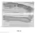 Fig. 12 - COMPOUNDS AND FORMULATIONS FOR THE TREATMENT OF WOUNDS