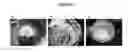 Fig. 02 - Abuse-deterrent opioids