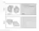 Fig. 05 - Methods of treating fibrosis