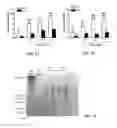 Fig. 02 - Methods of treating thyroid eye disease