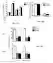 Fig. 16 - Methods of treating thyroid eye disease