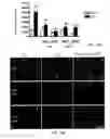 Fig. 19 - Methods of treating thyroid eye disease