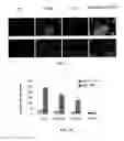 Fig. 20 - Methods of treating thyroid eye disease