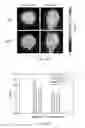 Fig. 23 - METHODS OF TREATING BRAIN ISCHEMIA OR HYPOXIA