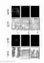 Fig. 06 - Methods for treating ischemia-reperfusion injury