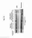 Fig. 08 - Methods for treating ischemia-reperfusion injury