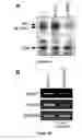 Fig. 04 - Methods and Compositions for Inducing Deregulation of EPHA7 and ERK Phosphorylation in Human Acute Leukemias