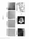 Fig. 16 - Induced hepatocytes and uses thereof