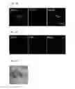 Fig. 46 - Induced hepatocytes and uses thereof