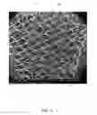 Fig. 13 - Method of treatment utilizing an acellular amnion derived therapeutic composition