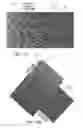 Fig. 14 - Method of treatment utilizing an acellular amnion derived therapeutic composition