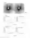 Fig. 11 - Designed peptides for tight junction barrier modulation