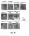 Fig. 06 - Lipid nanoparticles for wound healing