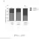 Fig. 19 - Lipid nanoparticles for wound healing