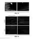 Fig. 15 - MODULATION OF AXON DEGENERATION