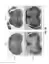 Fig. 27 - MODULATION OF AXON DEGENERATION