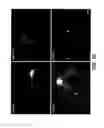 Fig. 50 - MODULATION OF AXON DEGENERATION