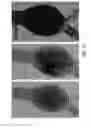 Fig. 14 - ALGINATE AND ALGINATE LYASE COMPOSITIONS AND METHODS OF USE