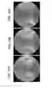 Fig. 19 - ALGINATE AND ALGINATE LYASE COMPOSITIONS AND METHODS OF USE