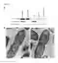 Fig. 02 - Live-attenuated vaccine against plague