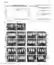 Fig. 20 - Live-attenuated vaccine against plague
