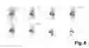 Fig. 07 - Peptides and peptide/active compound conjugates for renal targeting