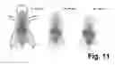 Fig. 12 - Peptides and peptide/active compound conjugates for renal targeting