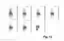 Fig. 14 - Peptides and peptide/active compound conjugates for renal targeting