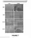Fig. 12 - Methods for treating cancer using an immunotoxin
