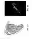 Fig. 12 - Compositions Comprising Fluorescent Dyes Associated With Viral Components For Nerve Imaging