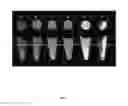 Fig. 02 - Multimodal imaging of fibrin