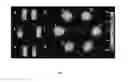 Fig. 03 - Multimodal imaging of fibrin