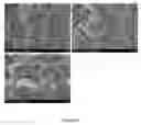 Fig. 07 - Injectable, biodegradable bone cements and methods of making and using same