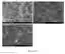 Fig. 15 - Injectable, biodegradable bone cements and methods of making and using same