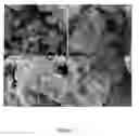 Fig. 04 - Injectable, biodegradable bone cements and methods of making and using same