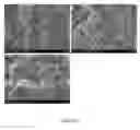 Fig. 07 - Injectable, biodegradable bone cements and methods of making and using same