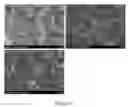Fig. 15 - Injectable, biodegradable bone cements and methods of making and using same