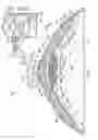 Fig. 02 - CLOSED ABDOMINAL MANIFOLD DRESSING