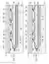 Fig. 04 - CLOSED ABDOMINAL MANIFOLD DRESSING