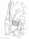 Fig. 01 - Catheter-based heart support system and method of implanting thereof