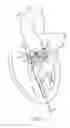 Fig. 04 - Catheter-based heart support system and method of implanting thereof